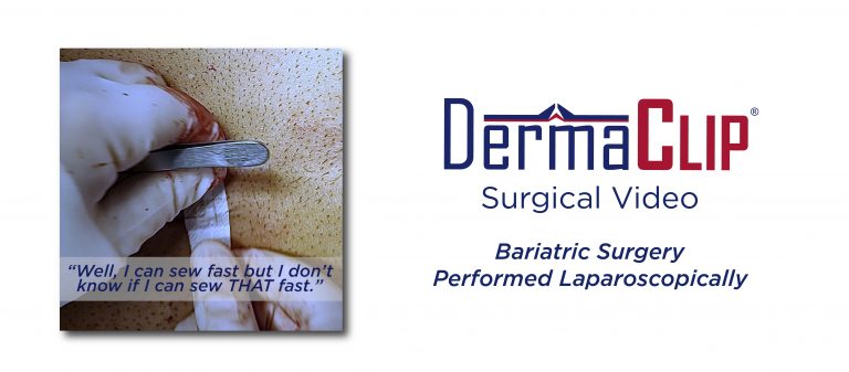 DermaClip closure of laparoscopic surgery